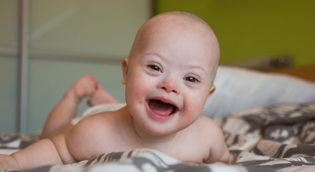 A smiling baby with Down syndrome on his or her tummy.